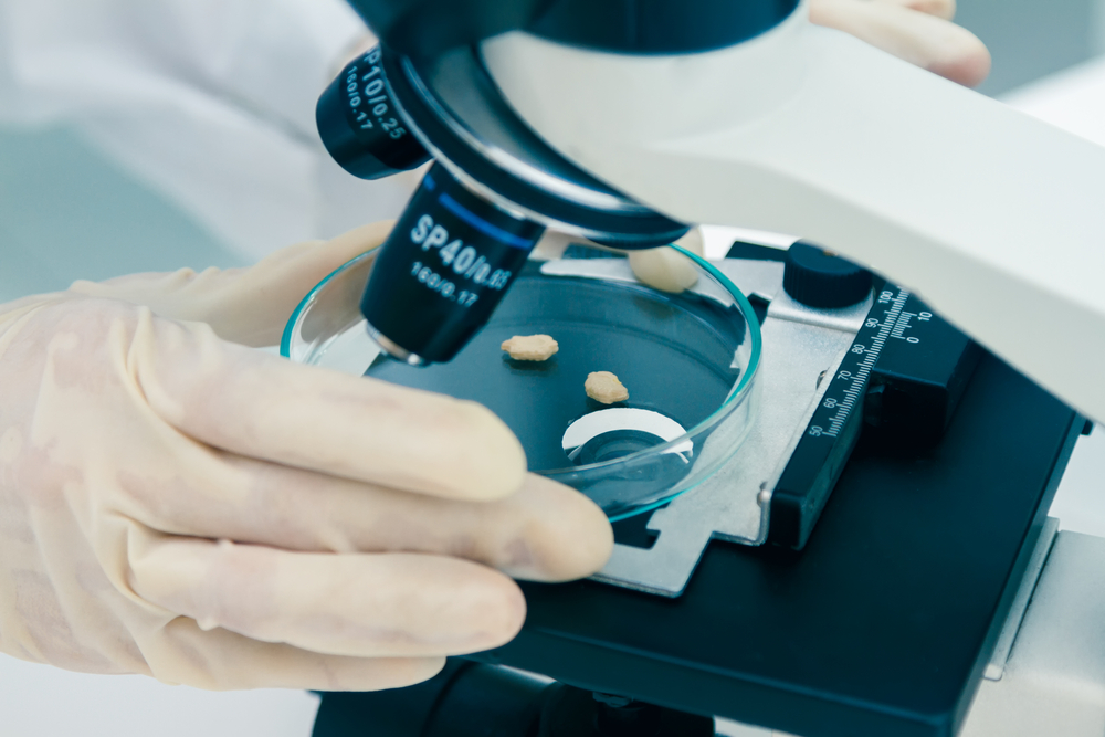 Benefícios da nanotecnologia para a indústria de alimentos no Brasil