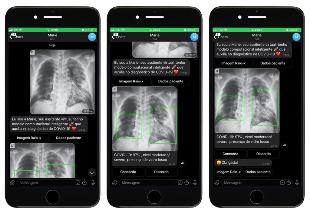 Aplicativo usa Inteligência Artificial e radiografias para combate ao coronavírus