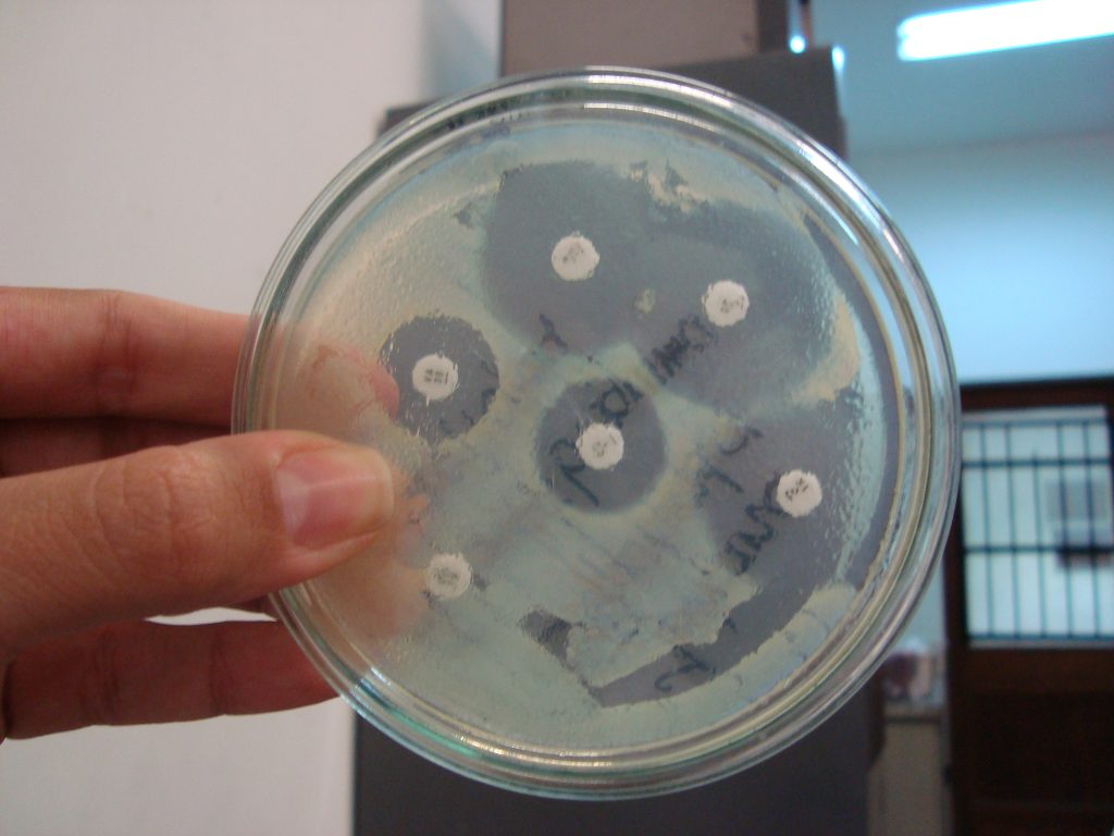 Antibiograma é próximo curso da bioMérieux para profissionais e estudantes de saúde no RJ