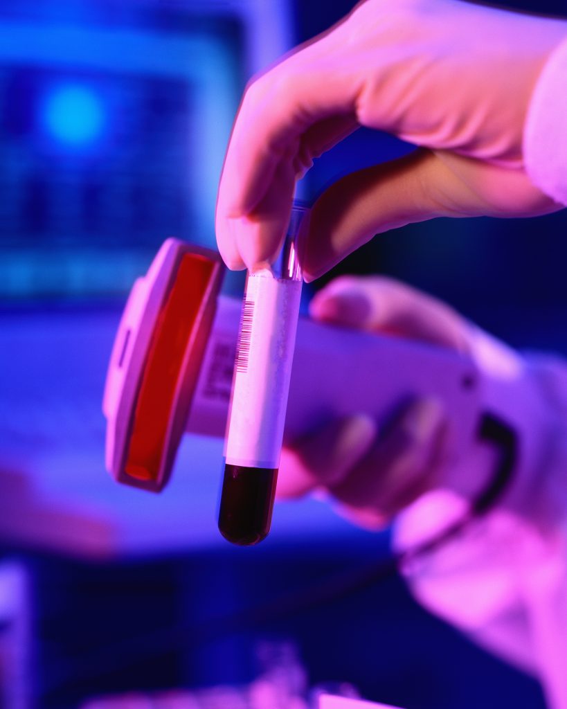 Planos de saúde cobrem exame de Zika para grávidas e bebês