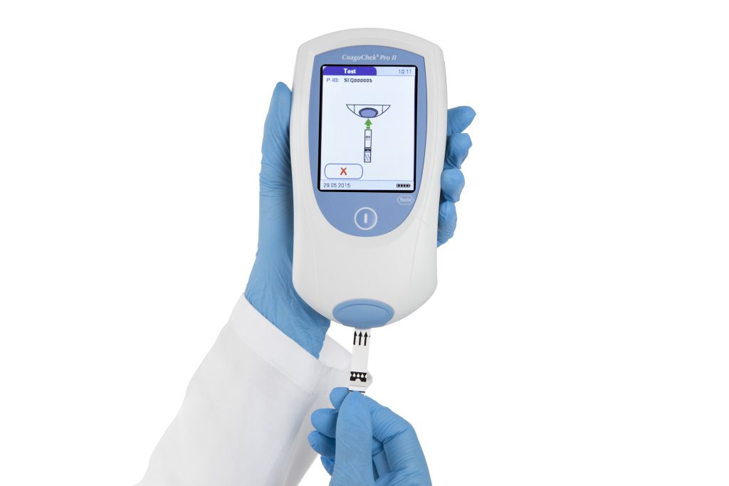 Novo equipamento para monitoramento da coagulação é aprovado pela Anvisa