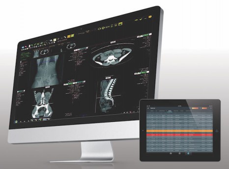 Exa Interprise Imaging
