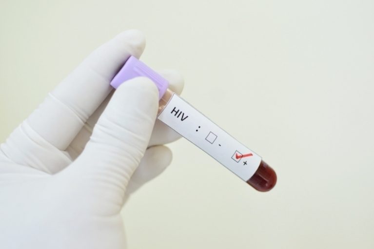 HIV-767x511