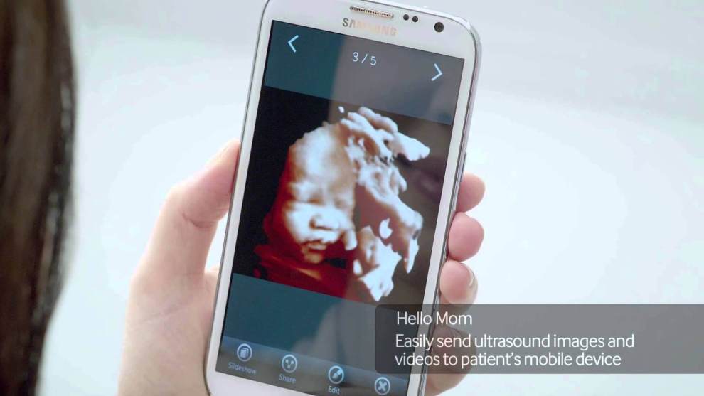 Aplicativo Hello Mom permite o compartilhamento de imagens do ultrassom do bebê