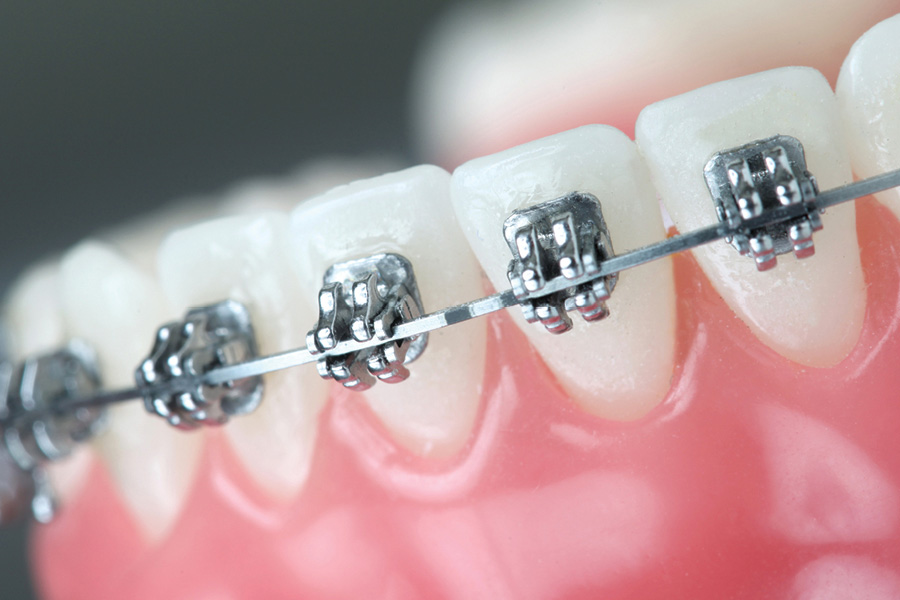 OrthoDontic apresenta modelo de franquia com faturamento mensal de aproximadamente R$ 200 mil, na Franchise4U em São Paulo