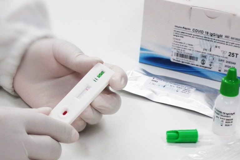 Teste_covid_sorologico