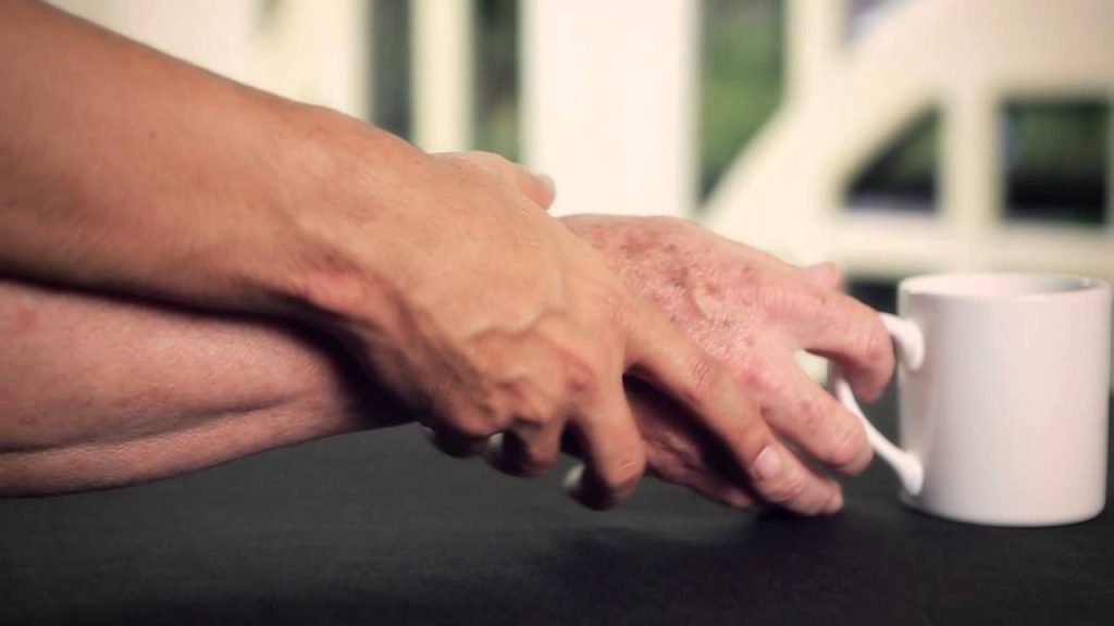 Machine Learning para compreender doença de Parkinson