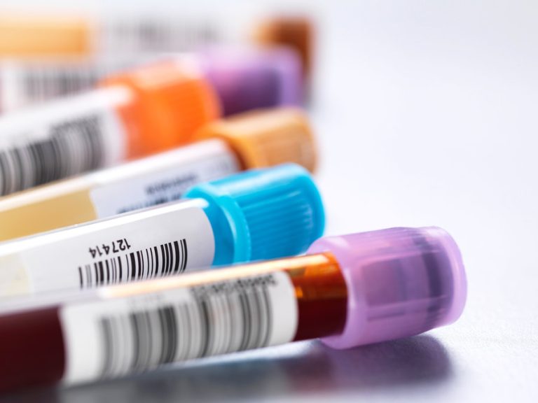 exames-de-sangue-para-alergias