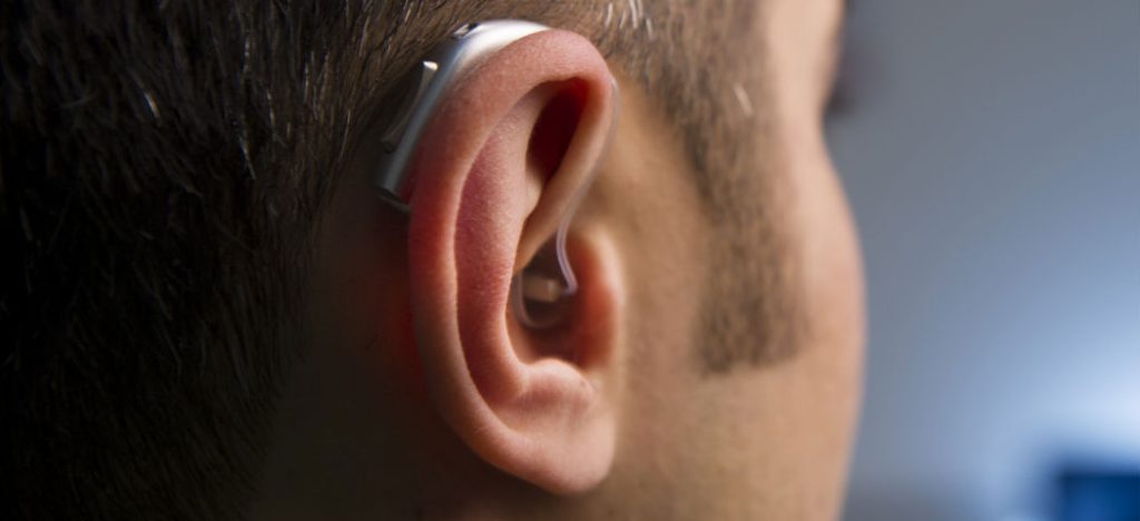 Seriam os hearables o futuro dos wearable devices? [Infográfico]