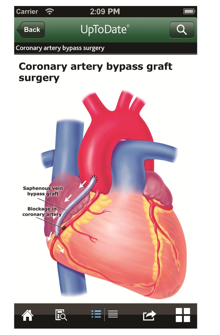 heart_screenshot_iphone branco