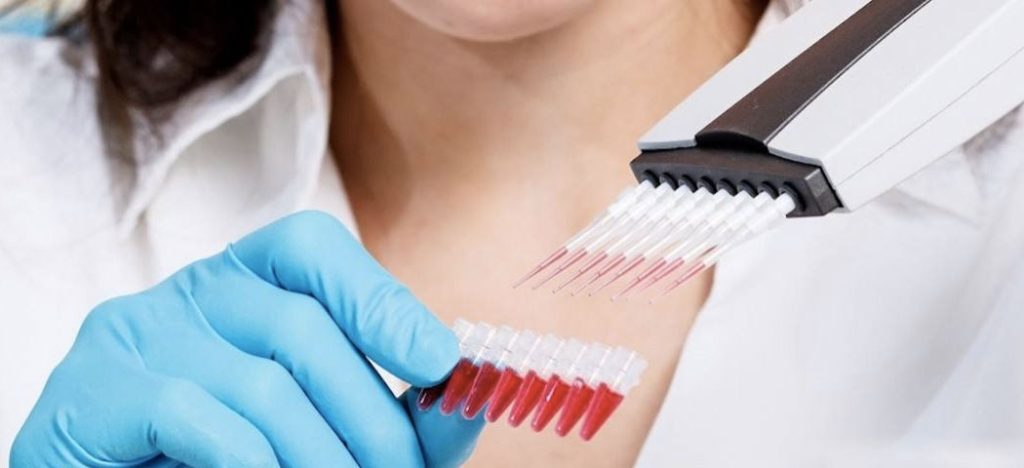 O que a Theranos pode Ensinar sobre Inovação em Saúde?