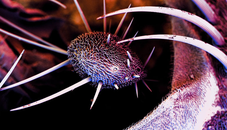 O que você sabe sobre o uso da Nanotecnologia na medicina? (#H20LA)