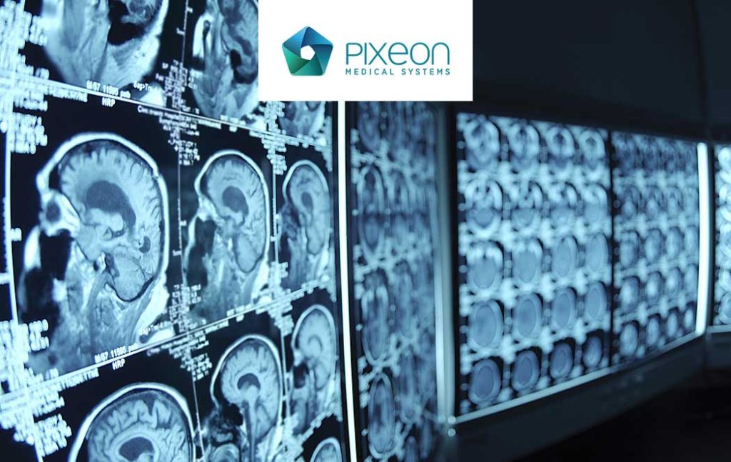 Pixeon, fazendo do Brasil o seu próprio Vale do Silício