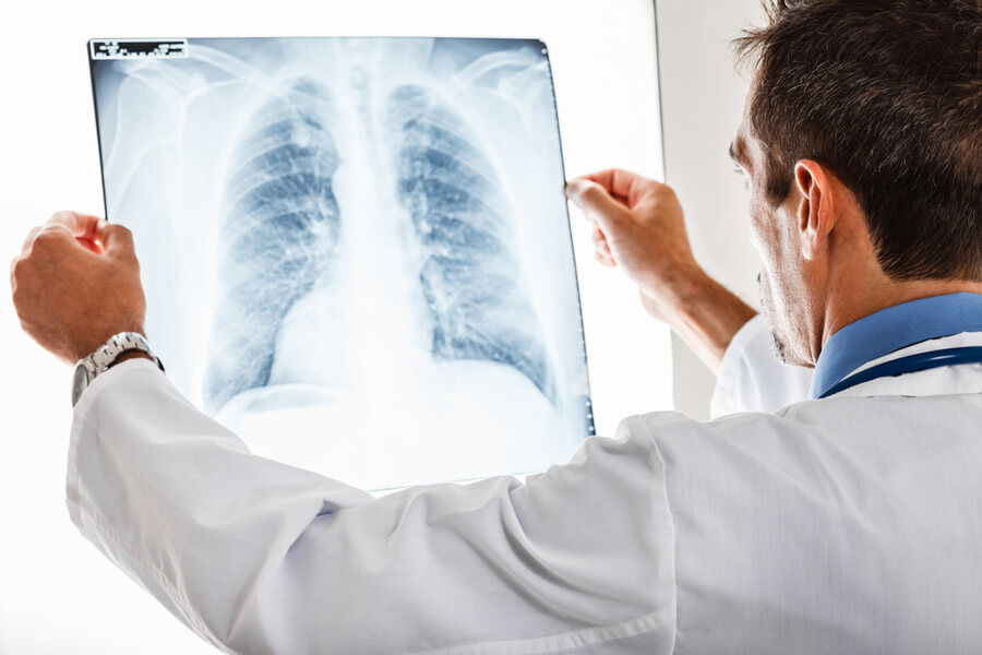 Philips expande o portfólio de informática para radiologia