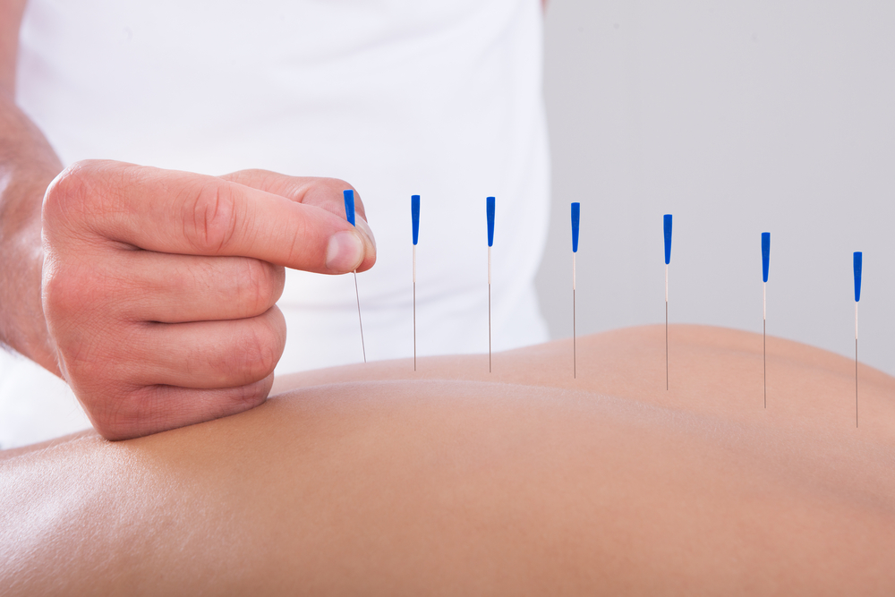 Simpósio de Acupuntura – Acupuntura e Dor: Ciência e Arte