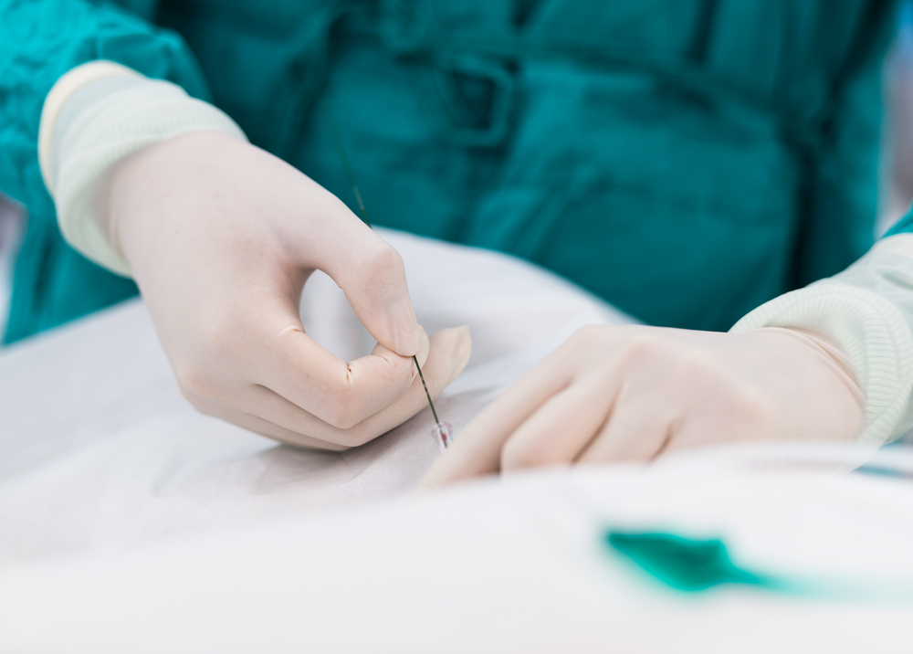 Hospital Bandeirantes participa do Congresso Internacional de Cirurgia Endovascular