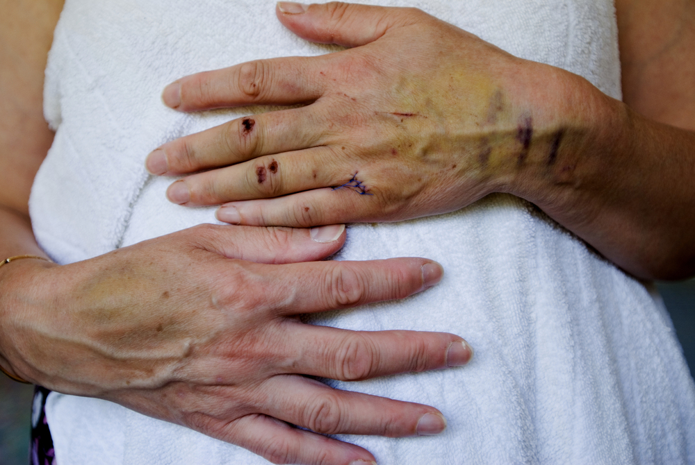 Organização Panamericana de Saúde revela que cresce violência contra profissionais de Saúde