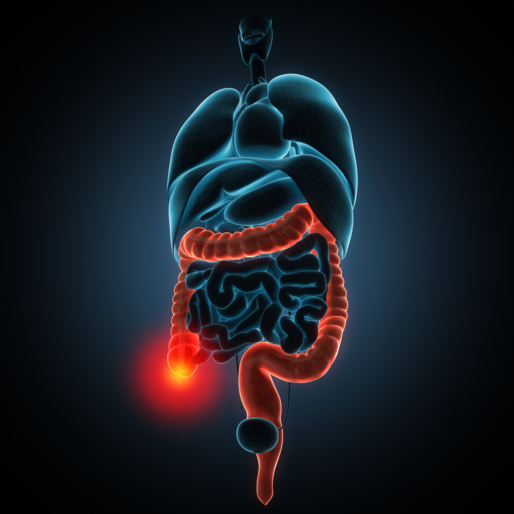 Tecnologias auxiliam no diagnóstico precoce do câncer colorretal