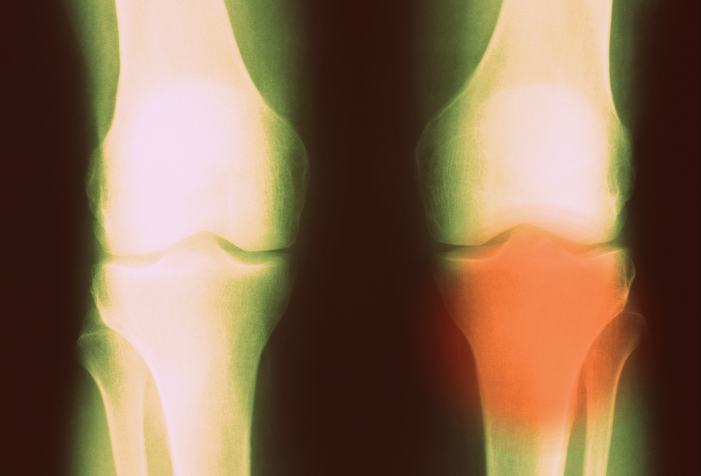 1ª premiação para residentes em reumatologia reconhecerá projetos voltados à melhoria do atendimento a pacientes