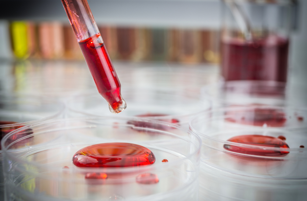 Determinação da ANS obriga planos de saúde a oferecerem exames de zika