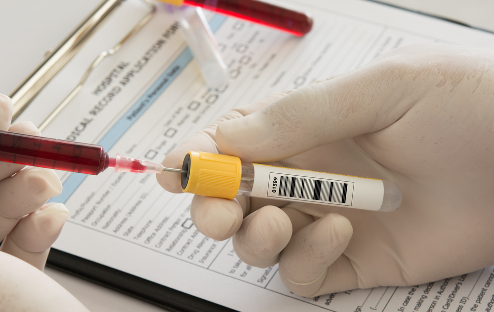 28.07 – Dia Mundial de Combate às Hepatites Virais Especialista da FIDI ressalta a importância do diagnóstico precoce
