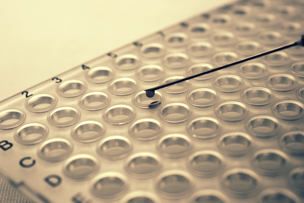 Delboni é o primeiro laboratório brasileiro a oferecer testes rápidos para casos de urgência no diagnóstico