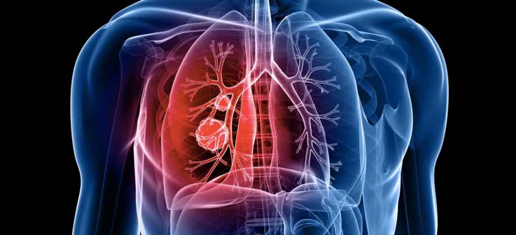 A Tecnologia no Combate ao Câncer