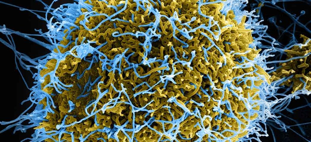 Seria a telemedicina a melhor forma de tratamento para o Ebola?