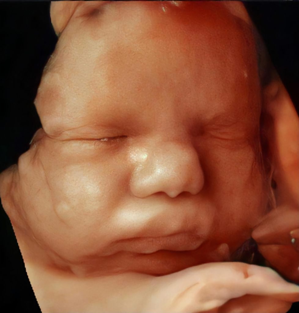 GE Healthcare lança ultrassom com alta definição de imagens para o público feminino