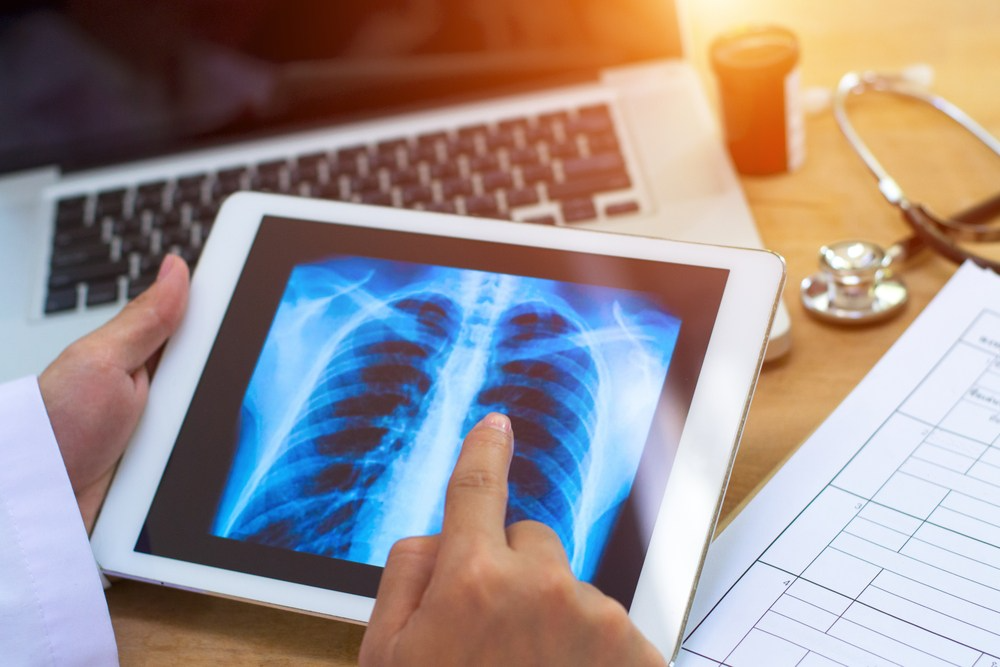 Telemedicina avança com a pandemia e chega até UTIs