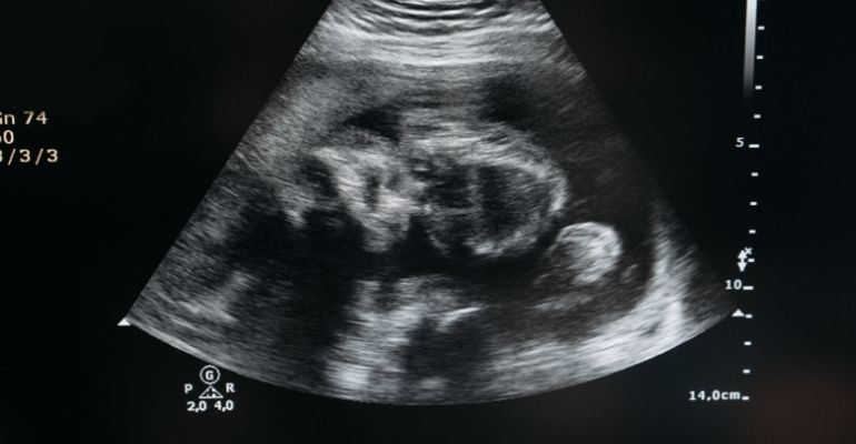 HCor e Grupo Santa Joana iniciam projeto de incentivo à Medicina Fetal no SUS