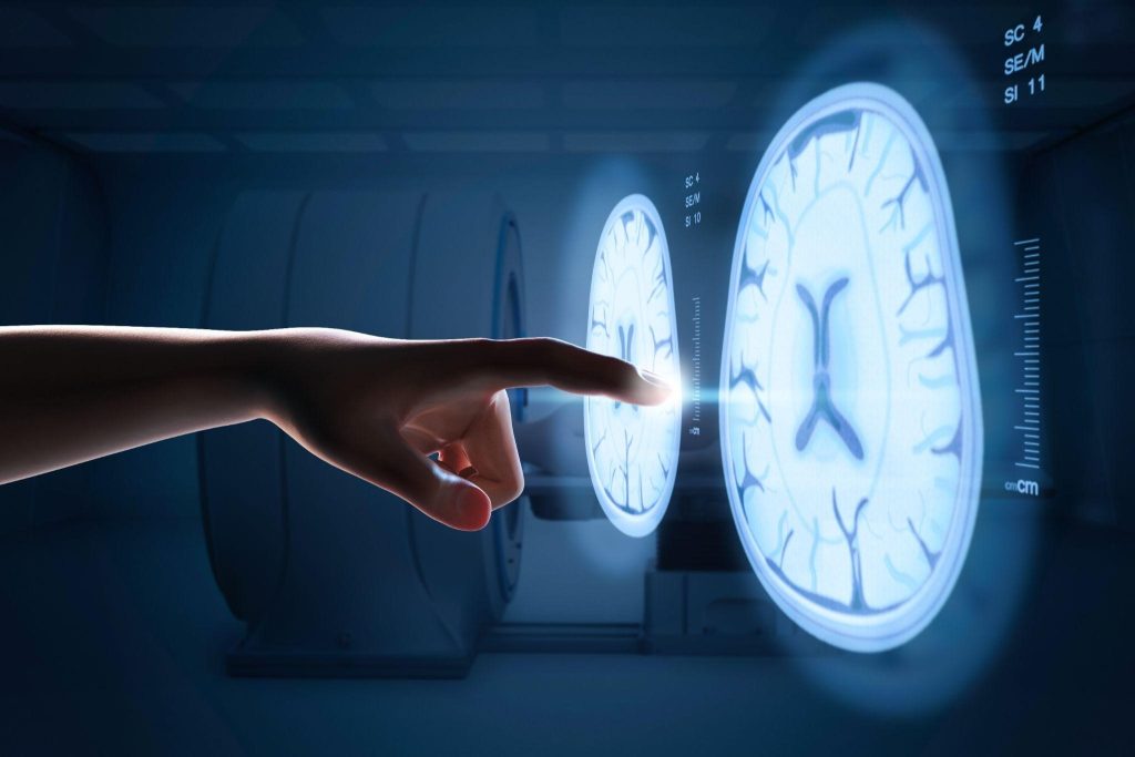 Visualização de imagens médicas, um salto na medicina diagnóstica