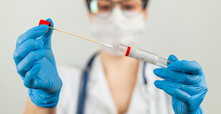 Volume de testes para COVID-19 aumentam 39% em janeiro