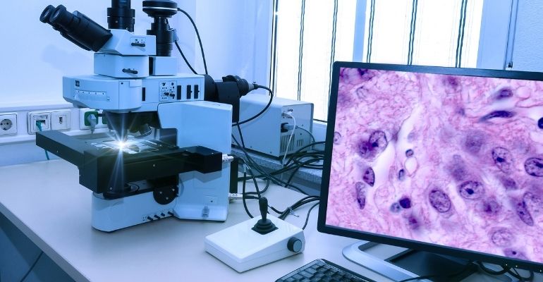 Ferramenta aumenta em 50% a probabilidade de previsão de tumores subsequentes ao câncer infantil