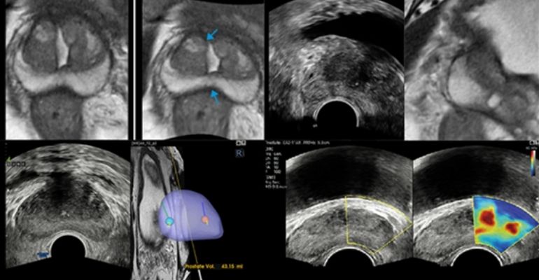 Conheça soluções da Samsung para o diagnóstico de câncer