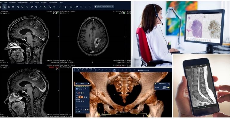 Saúde em Rede: NHS compartilha imagens médicas em todo o Reino Unido