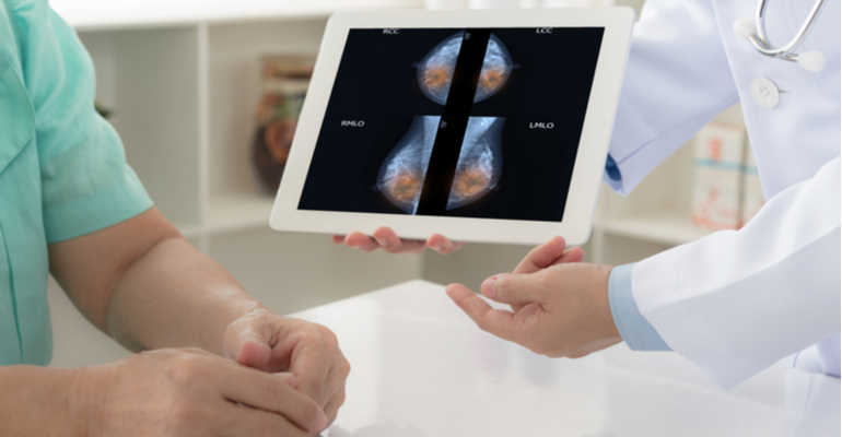 Estudo brasileiro sobre câncer de mama hereditário revela importância de ir além do BRCA 1 e 2