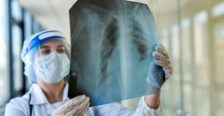 Pessoas com sequelas da Covid-19 podem precisar de tratamento ortopédico