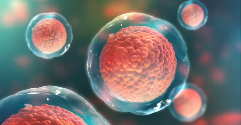 Exame possibilita o monitoramento de transplantados de medula a partir da comparação entre o DNA do doador e o do receptor