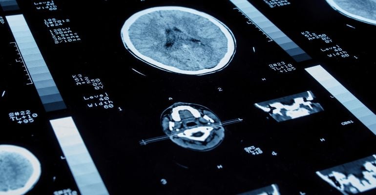 FIDI lança portal com dados sobre exames de imagem no SUS