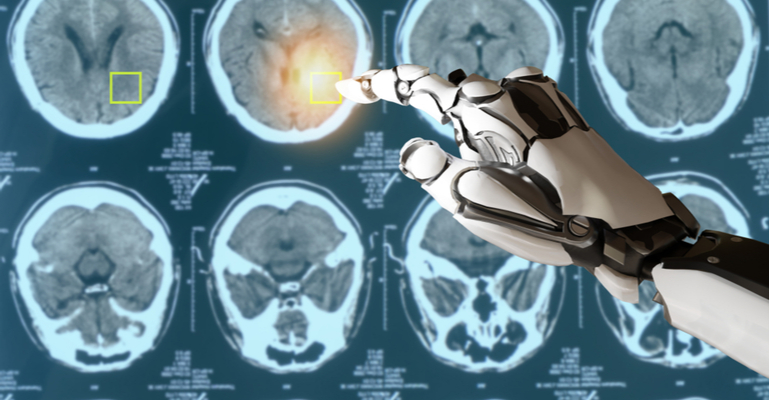 Healthtech usa Inteligência Artificial para diagnosticar precocemente câncer