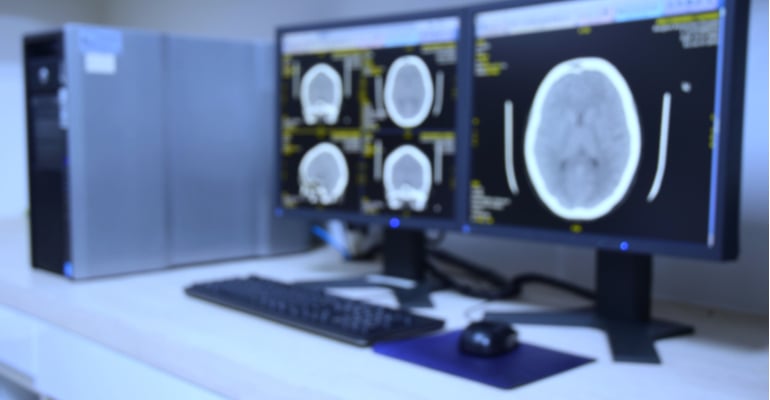 Inteligência Artificial e Radiologia: Revolução do diagnóstico por imagem está em destaque na medicina