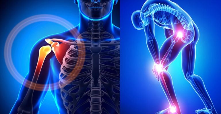 Quando joelho, quadril e ombro falam sem parar: “Orthopedics Smart Implants”