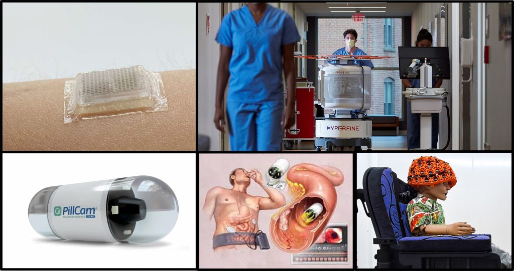 Vamos vestir ultrassom, ingerir endoscopia e fazer ressonância em casa