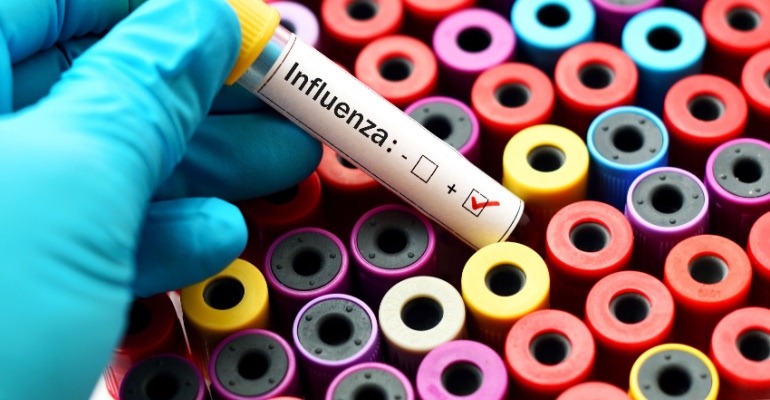 Dasa identifica alta de casos de Influenza A