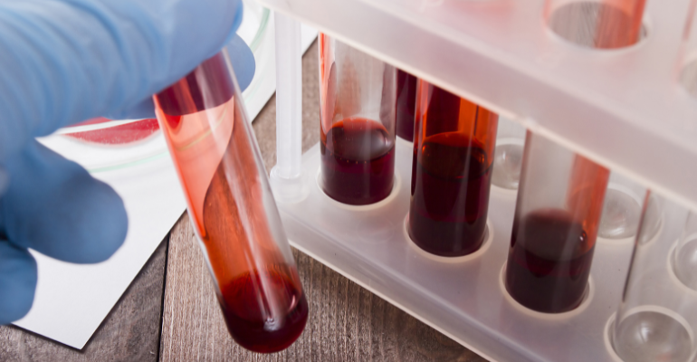 Novembro azul: média mensal de exames PSA aumenta 17% até setembro de 2022, segundo Abramed