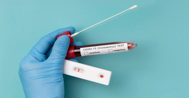 Número de exames de Covid nos laboratórios triplica. Taxa de positividade eleva 400%