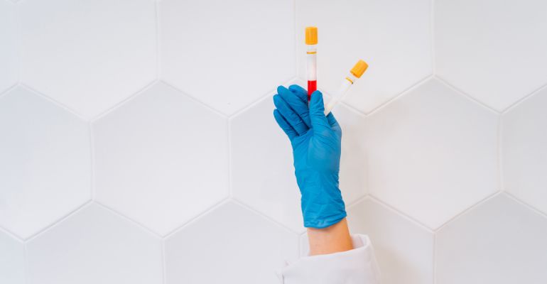 Cidade paranaense combate surto de Dengue com uso de inteligência artificial