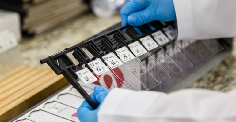 Rede D’Or monta laboratório de biologia molecular oncológica