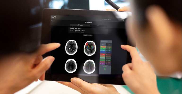 INC diminui tempo de atendimento de AVC com ajuda de Inteligência Artificial